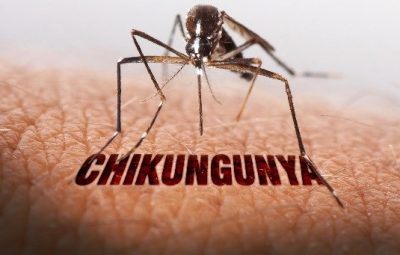 676132422 400x255 - Sesa divulga boletim de Chikungunya