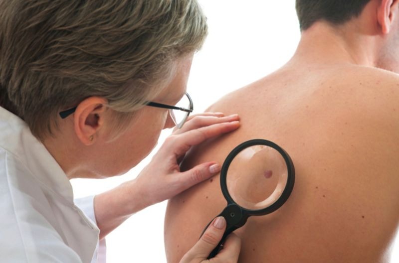 Câncer de pele: especialista alerta para os cuidados com a pele