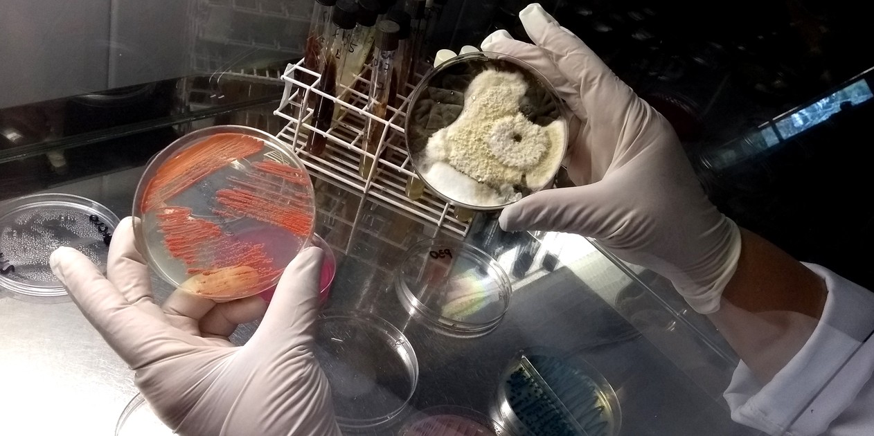 Pesquisa em roupas íntimas encontra 10 mil bactérias e fungos com risco de infecções; médicos fazem alerta