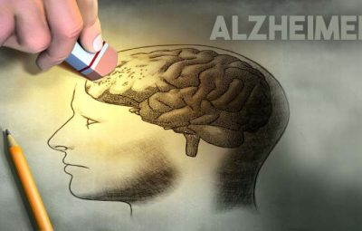 alzheimer ilustracao 400x255 - 5 passos para prevenir o Alzheimer
