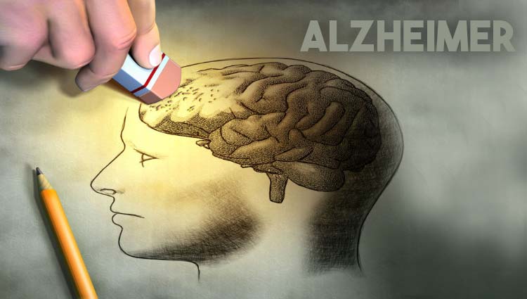 5 passos para prevenir o Alzheimer