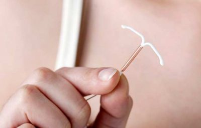 contraceptivo DIU 400x255 - Ministério amplia acesso ao contraceptivo DIU no Sistema Único de Saúde