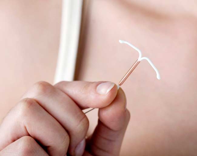 Ministério amplia acesso ao contraceptivo DIU no Sistema Único de Saúde