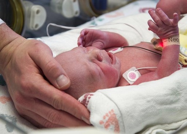 Mulher com útero transplantado tem bebê saudável nos Estados Unidos