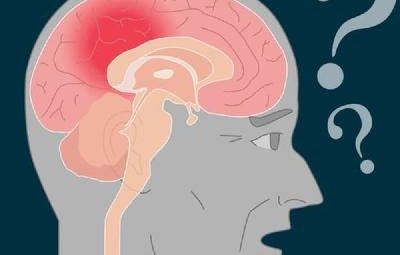 Alzheimer 400x255 - 'É uma perda em vida': Os desafios diante do Alzheimer, doença que põe em xeque a racionalidade