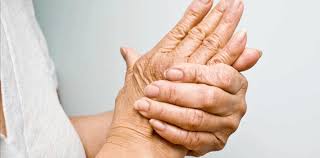 Pesquisa revela impactos da artrite reumatoide em pacientes - Pesquisa revela impactos da artrite reumatoide em pacientes