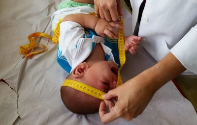 microcefalia 400x255 - Mães de bebês com microcefalia vivem novos desafios