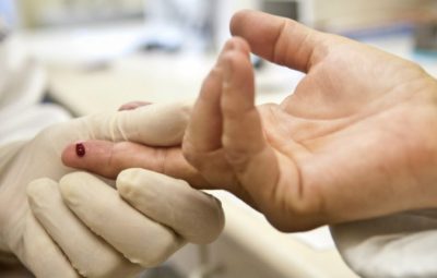 Tire todas as suas dúvidas sobre Aids e HIV 400x255 - Tire todas as suas dúvidas sobre Aids e HIV