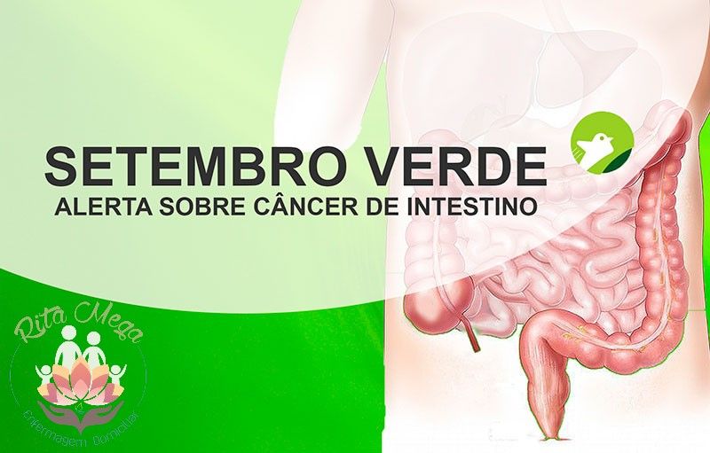 Fique atento aos sinais do corpo que podem indicar o câncer do intestino