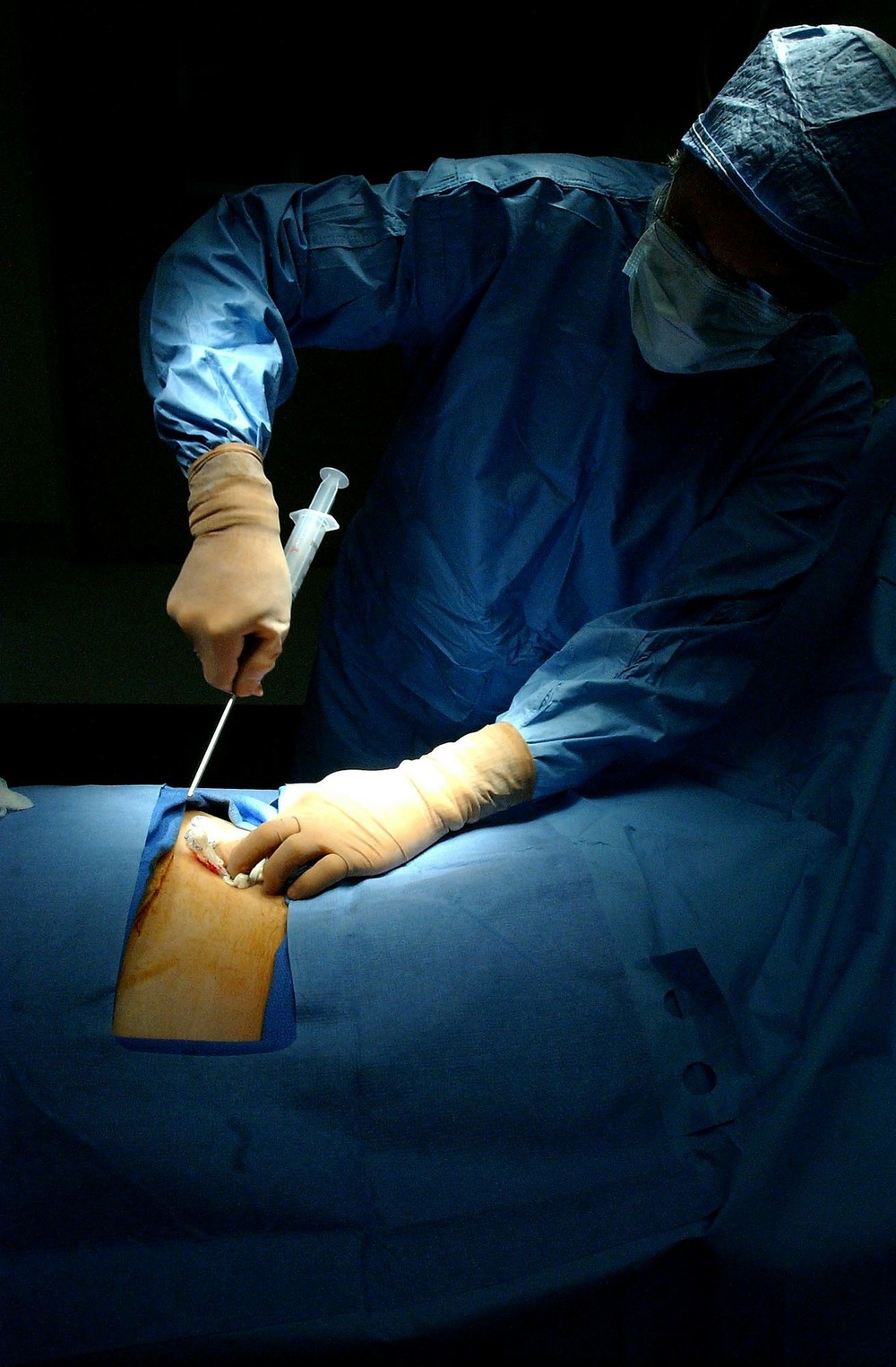 Novo material pode substituir transplante de medula óssea, diz estudo