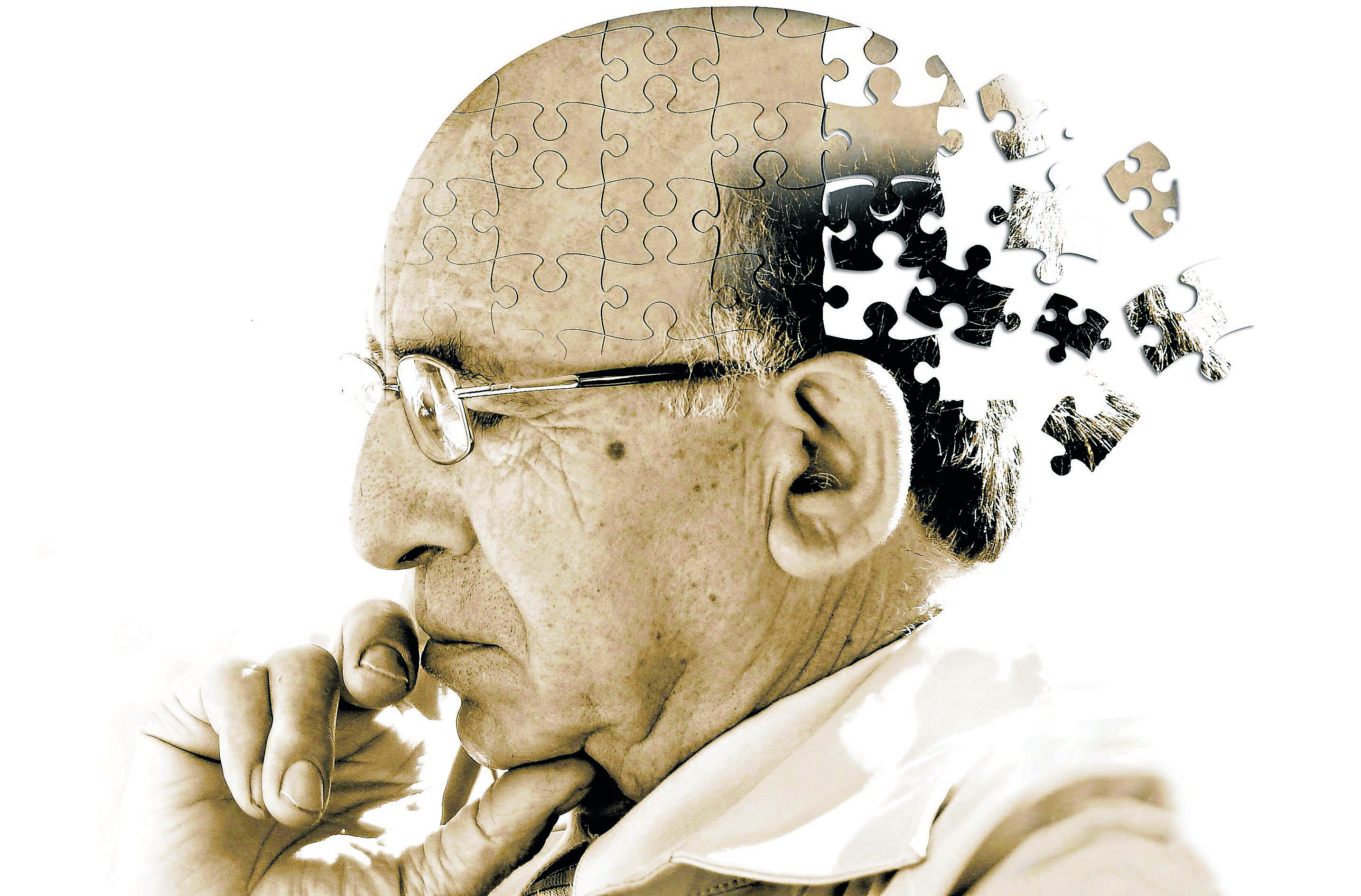 Dia Mundial do Alzheimer alerta para impacto da doença