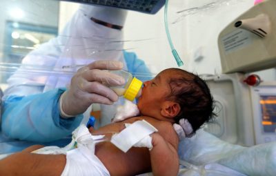 bebe 400x255 - Unicef: 1 a cada 3 crianças menores de 5 anos não cresce adequadamente