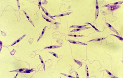 leishmania 400x255 - Doença similar à leishmaniose, porém mais grave, é descoberta no país