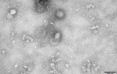 Novo coronavírus 28 casos suspeitos foram descartados no Brasil 400x255 - Novo coronavírus: 28 casos suspeitos foram descartados no Brasil