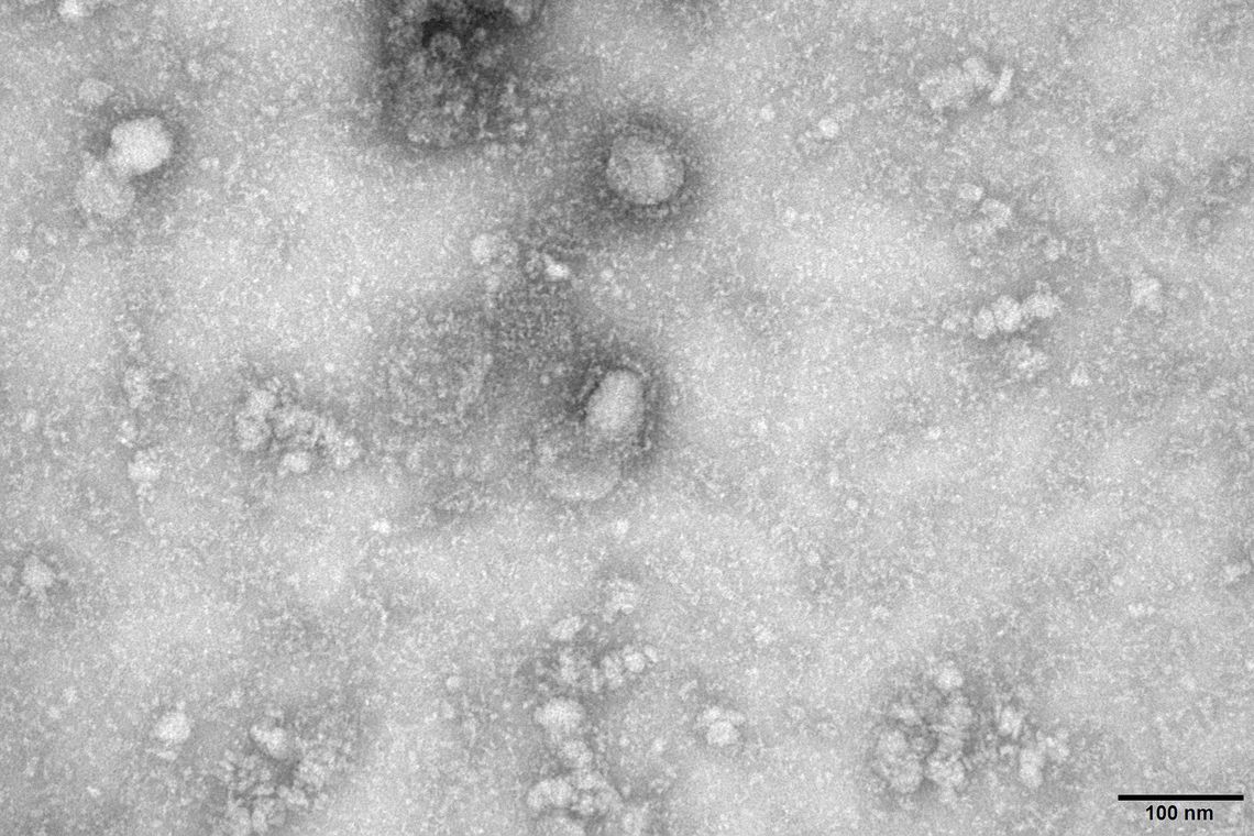 Novo coronavírus: 28 casos suspeitos foram descartados no Brasil