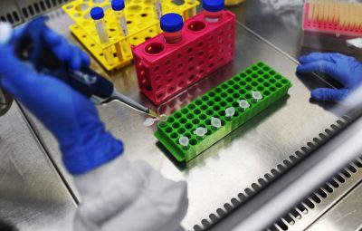 corona 3 400x255 - Número de mortes pelo novo coronavírus no Brasil chega a 159