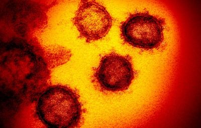 coronavirus visao microscopio 400x255 - ES tem 37 casos suspeitos do novo coronavírus; paciente diagnosticada é liberada