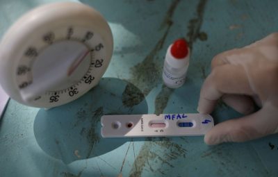 coronavirus teste covid   19 400x255 - São Paulo tem 202.967 mil pessoas recuperadas de covid-19