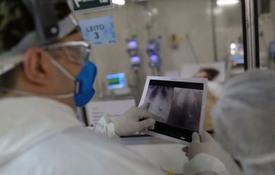 radiografia de torax coronaviruscovid 19 hospital sao paulo1205200326 1 400x255 - STF adia decisão sobre demissão em massa sem negociação sindical