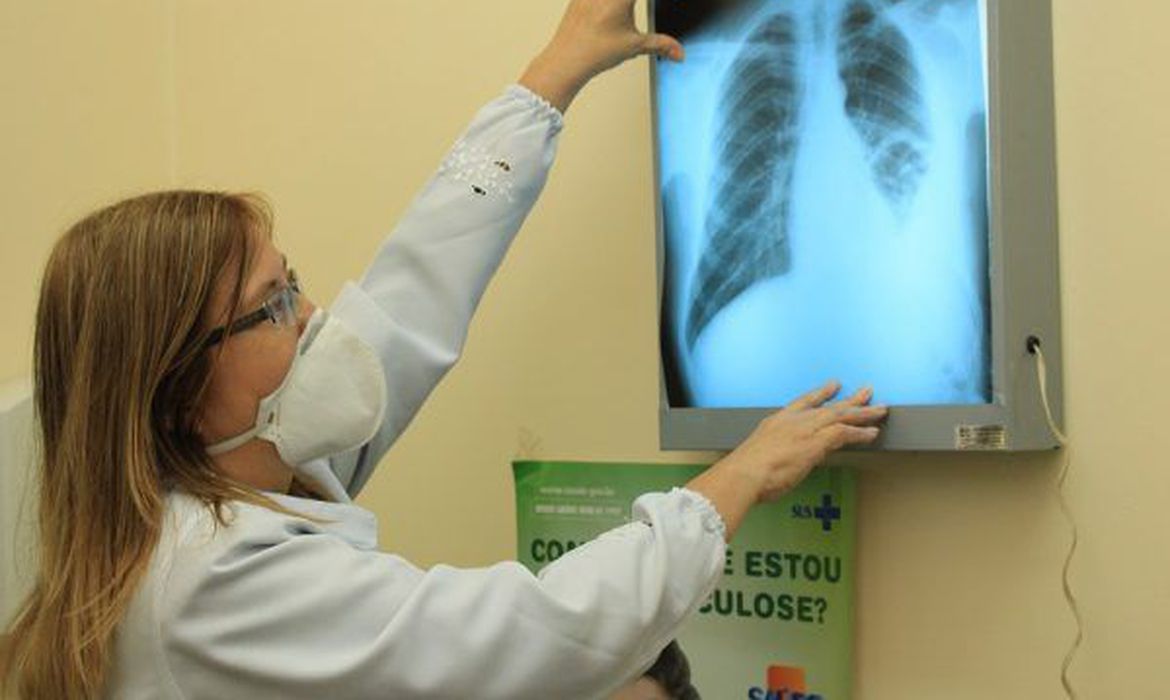 Pesquisadores do Brics buscam interconexões entre tuberculose e covid