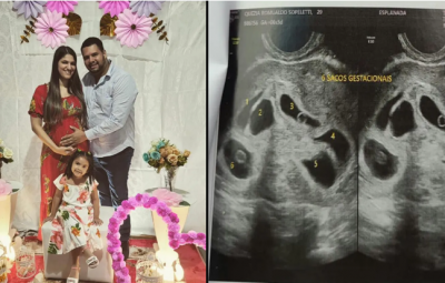 gravida 400x255 - Mãe descobre que está grávida de sêxtuplos no ES: 'Fui na consulta só para ver 1 bebê e descobri 6'