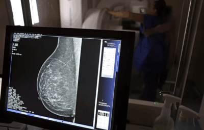 Ministério da Saúde passa a recomendar mamografia a partir dos 40 anos mamografia 400x255 - Ministério da Saúde passa a recomendar mamografia a partir dos 40 anos