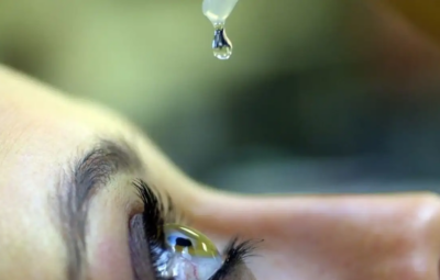 colirio 400x255 - Uso indiscriminado de corticoides pode causar glaucoma e cegueira