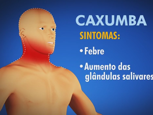 caxumba - Caxumba passa a ter notificação obrigatória