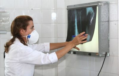 Exames ajudam a identificar a tuberculose 400x255 - Tuberculose mata 4.500 pessoas todos os dias no mundo