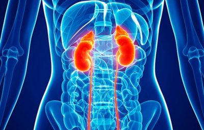 doença renal crônica 400x255 - Mais de 2 mil capixabas fazem tratamento contra doença renal crônica