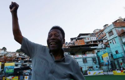 Pele 400x255 - Exames detectam cálculo em ureter esquerdo de Pelé