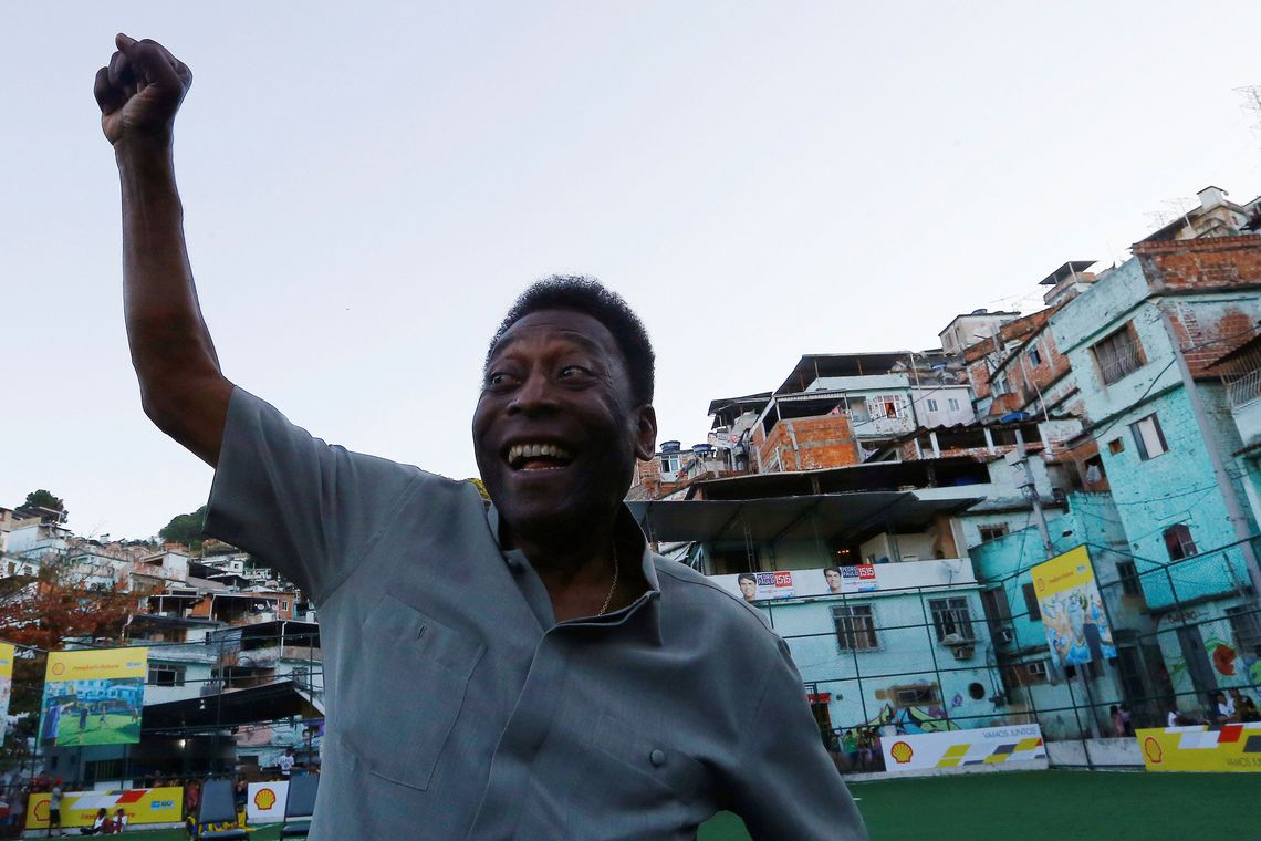 Exames detectam cálculo em ureter esquerdo de Pelé