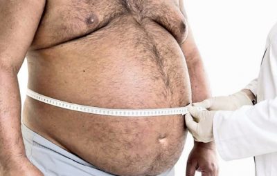 Cirurgia bariátrica saúde em primeiro lugar 400x255 - Cirurgia Bariátrica: entenda as mudanças na libido após o procedimento