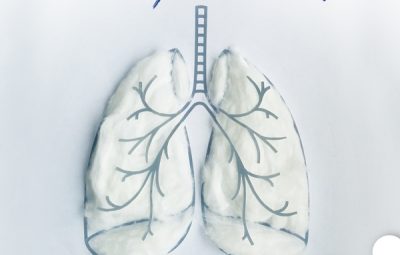 Conscientização do Câncer de Pulmão 400x255 - Sambista amador, paciente faz dueto com seus ídolos em ação digital que destaca os fatores  de risco e o diagnóstico precoce do tumor, que é a principal causa de morte por câncer no Brasil