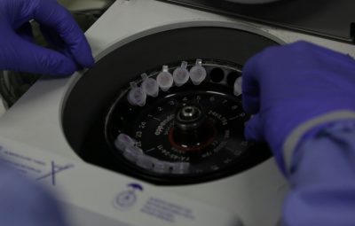 diagnostico laboratorial de casos suspeitos do novo coronavirus 400x255 - Sobem para 11 os casos suspeitos de infecção pelo novo coronavírus