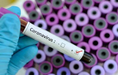coronavirus 4 400x255 - Primeiros afetados pela covid-19 no Brasil tinham, em média, 39 anos