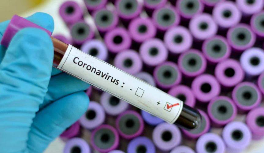 Espírito Santo tem 71 casos confirmados do novo Coronavírus (Covid-19) até este domingo (29)