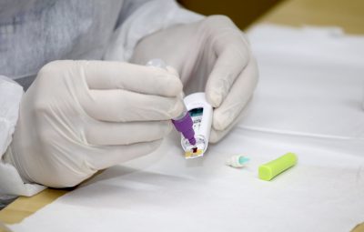 covid 19 400x255 - Brasil registra segundo maior número de novos casos de Covid-19 em 24 horas