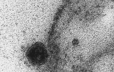 fiocruz 20200403 debora barreto 00002coronavirus 400x255 - USP: novo coronavírus infecta e se replica em glândulas salivares