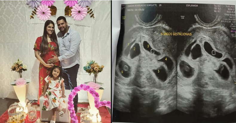 Mãe descobre que está grávida de sêxtuplos no ES: ‘Fui na consulta só para ver 1 bebê e descobri 6’