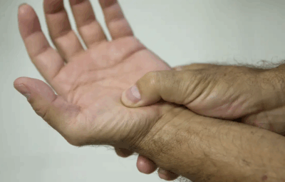 fibromialgia 400x255 - Lei define fibromialgia como deficiência em todo país a partir de 2026