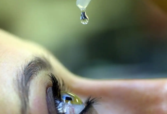 colirio 670x460 - Uso indiscriminado de corticoides pode causar glaucoma e cegueira