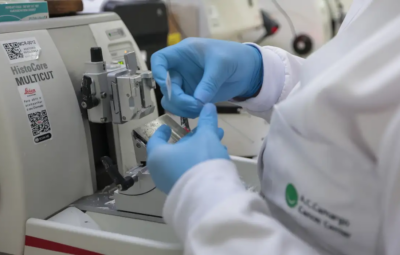sus 400x255 - SUS inclui nova terapia para pacientes adultos com leucemia mieloide